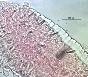 Photomicrograph of a slide mounted worm with evenly spaced bundles of chaetae. All chaetae are simple and straight.