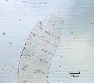 photomicrograph showing the front end of a worm with sets of two chaetae in each bundle