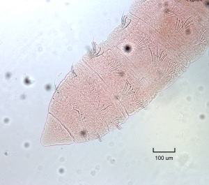 Photomicrograph of a slide mounted worm with evenly spaced bundles of chaetae. Dorsal bundles have short hairs and rounded bifid chaetae, while ventral bundles have just rounded bifid chaetae.