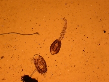 microscope picture of two organisms. Both have round parts and one has a tail