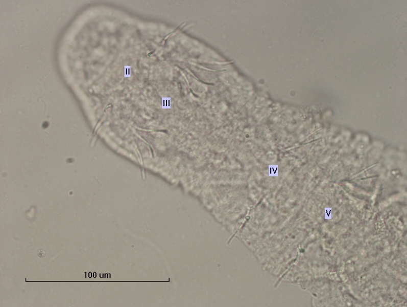 photomicrograph of a freshwater oligochaete worm with segments II, III, IV, and V labelled. There is a gap between III and IV.
