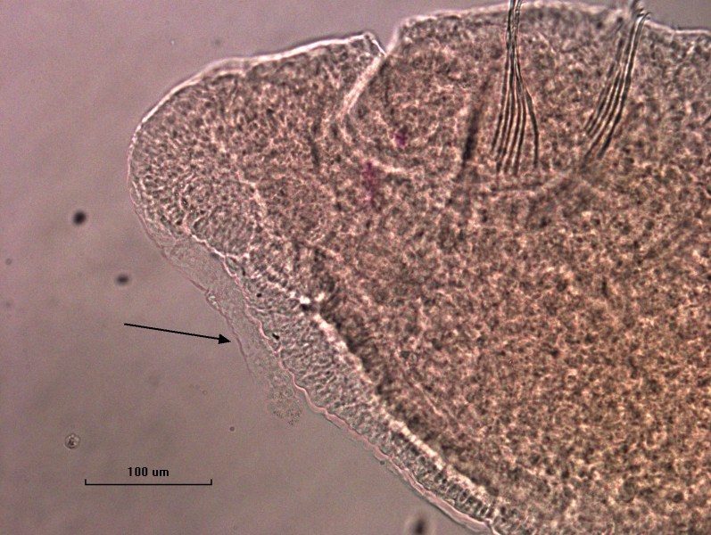 Photomicrograph of a slide mounted worm. An arrow points to a proboscis that lies along the head