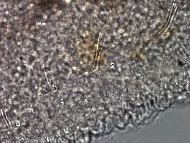 Photomicrograph of part of a freshwater oligochaete worm showing the first few bundles of chaetae, labelled V and VI, both are long with the upper tooth longer than the lower