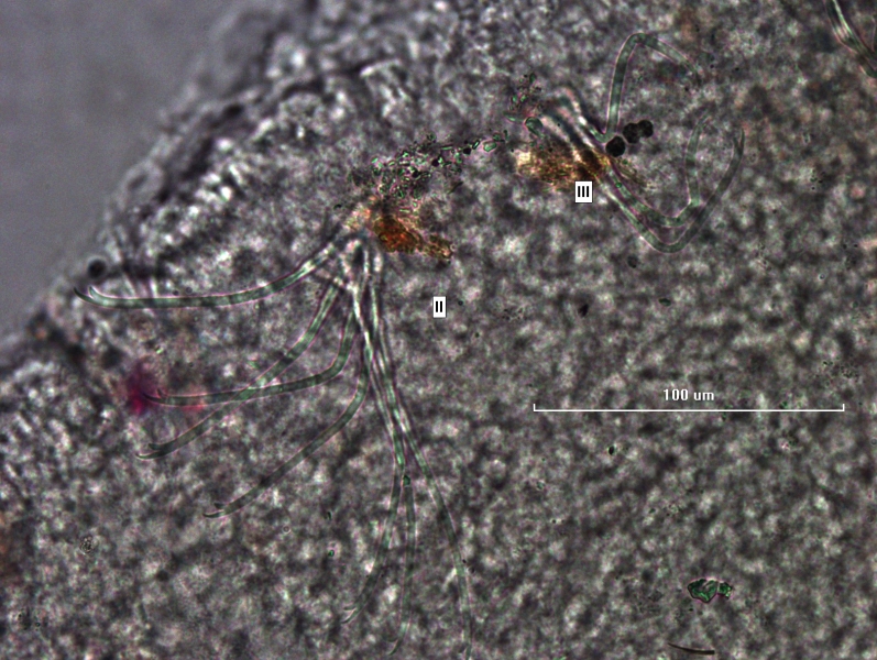 Photomicrograph of part of a worm showing the first few bundles of chaetae, labelled II and III