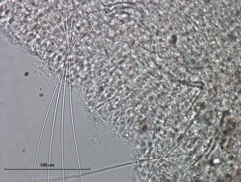 photomicrograph of part of a worm showing thin hairs that cross close to the body of the worm