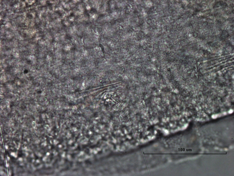 photomicrograph of part of a freshwater oligochaete worm showing thin short hairs arranged in a line with one long hair bent in a different direction