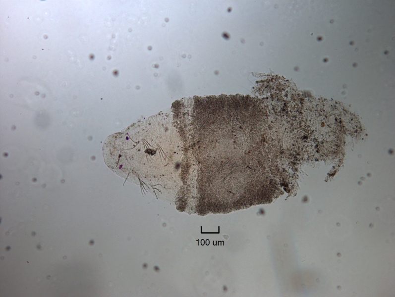 Photomicrograph of a whole freshwater oligochaete worm with a thickened clitellum; the worm is broken after the clitellum. There are eyespots and three segments with chaetae, then penial chaetae in the clitellum