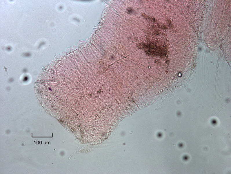 Photomicrograph of a freshwater oligochaete worm with a square head that appears like a fragment, but includes eyespots, anterior ventrals, dorsal chaetae starting in VI that cross each other in a tent shape.