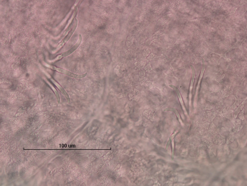 Photomicrograph of part of a freshwater oligochaete worm showing two bundles of chaetae that are simple-pointed or have a minute second tooth. The skin is a rough pebbly texture. Scale bar 100 um.