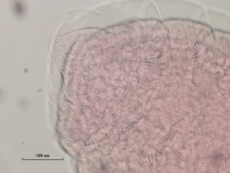 Photomicrograph of the first few segments of a freshwater oligochaete worm showing the pointed prostomium, a mouth, and several bundles of chaetae in two segments. The chaetae are simple-pointed or have a minute second tooth. The skin is a rough pebbly texture. Scale bar 100 um.