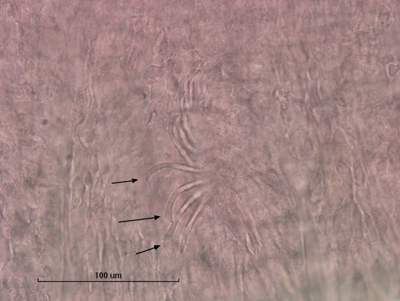 Photomicrograph of part of a freshwater oligochaete worm showing a bundle of nine chaetae with arrows pointed to a few of them. The chaetae are brush-like at the very end. The skin is a rough pebbly texture. Scale bar 100 um.