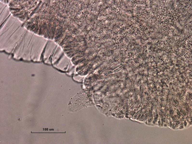 Photomicrograph of part of a freshwater oligochaete worm showing a reproductive structure in the clitellum. There is a soft pseudopene protruding from the body. Scale bar 100 um.