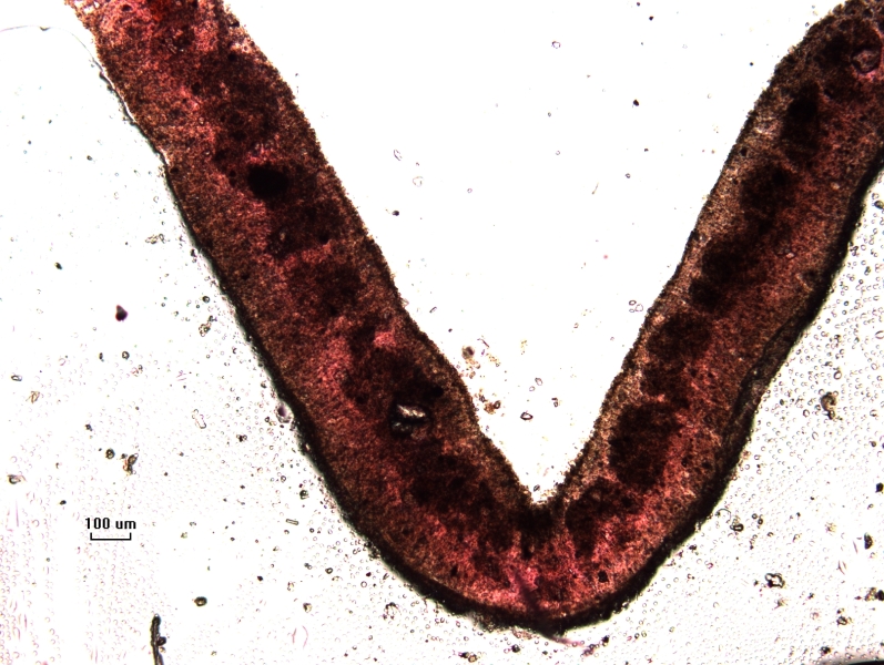 Photomicrograph of part of a freshwater oligochaete worm showing the body encased in a tight covering of sediment. Scale bar 100 um.