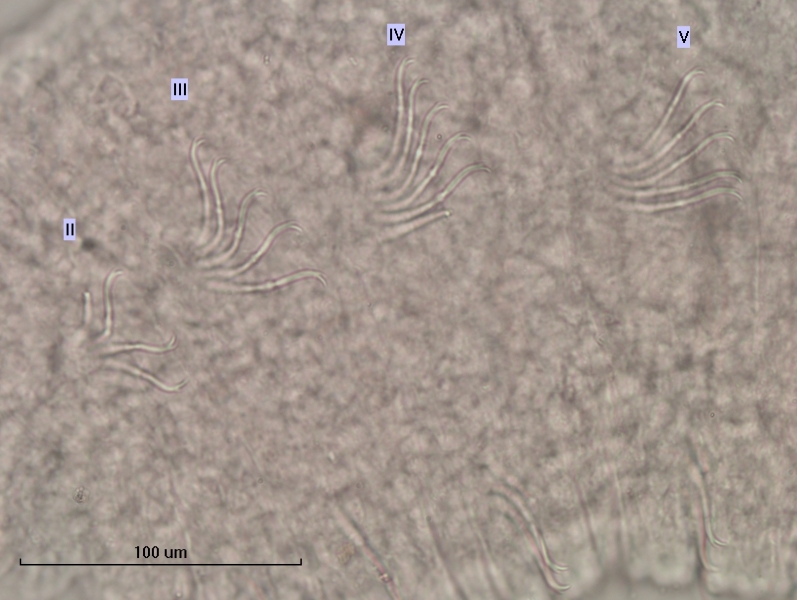 photomicrograph of part of a freshwater oligochaete worm showing the bifid chaetae of segments II, III, IV, and V. The chaetae are slightly S-shaped and the upper tooth is shorter and thinner than the lower tooth. Scale bar 100 um.
