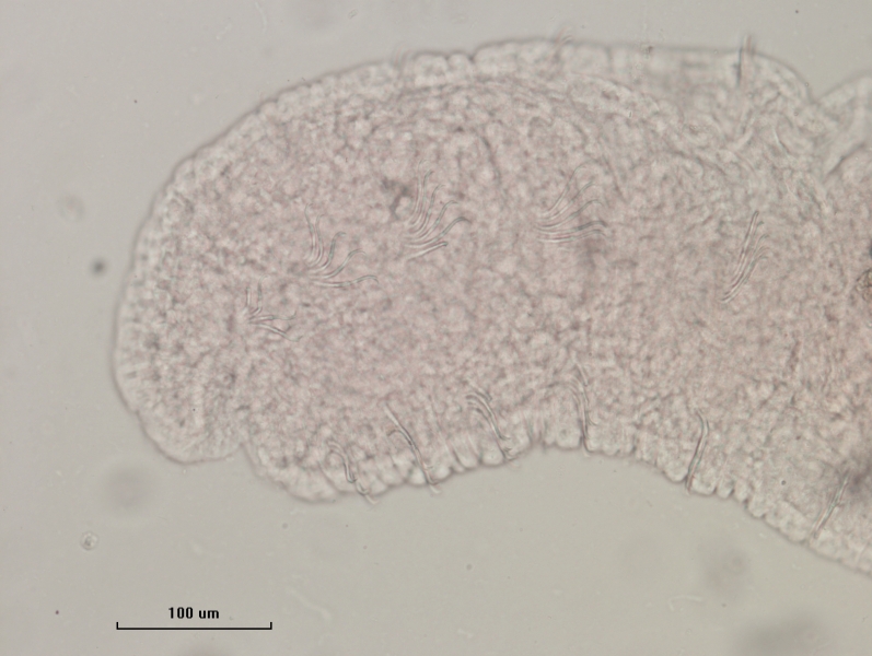 photomicrograph of the head of a freshwater oligochaete worm showing the first few segments with slightly S-shaped bifid chaetae. Scale bar 100 um.