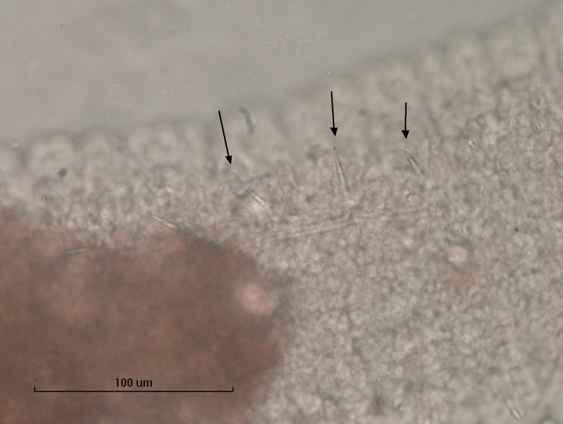 photomicrograph of part of a freshwater oligochaete worm showing some segments with hairs shaped like crochet hooks. They are wide and flat with a tooth at the tip. Scale bar 100 um.