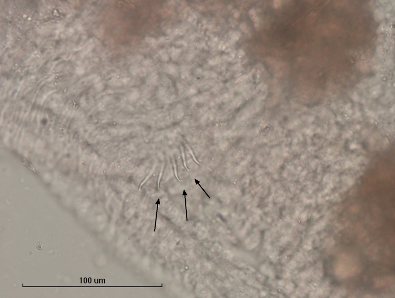 photomicrograph of part of a freshwater oligochaete worm showing a segment with hairs that are slighlyt curved and flattened from the side, the upper tooth is very short compared to the lower tooth. Scale bar 100 um.
