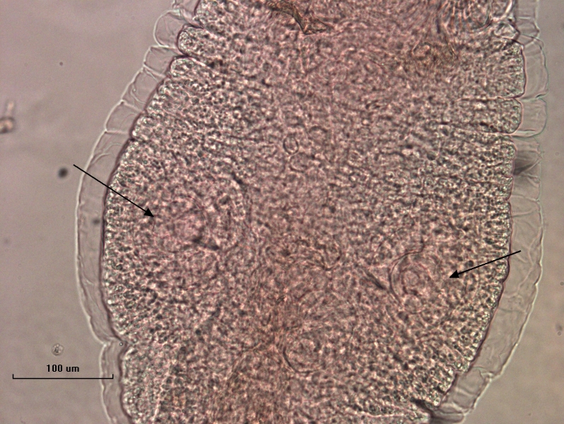photomicrograph of part of a freshwater oligochaete worm showing the thickened clitellum with two round features with arrows pointing to them. Scale bar 100 um.