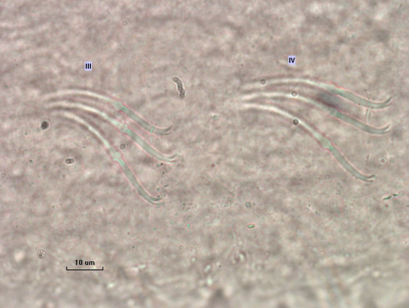photomicrograph of part of a freshwater oligochaete worm showing segments III and IV with slightly curved chaetae with the upper tooth shorter