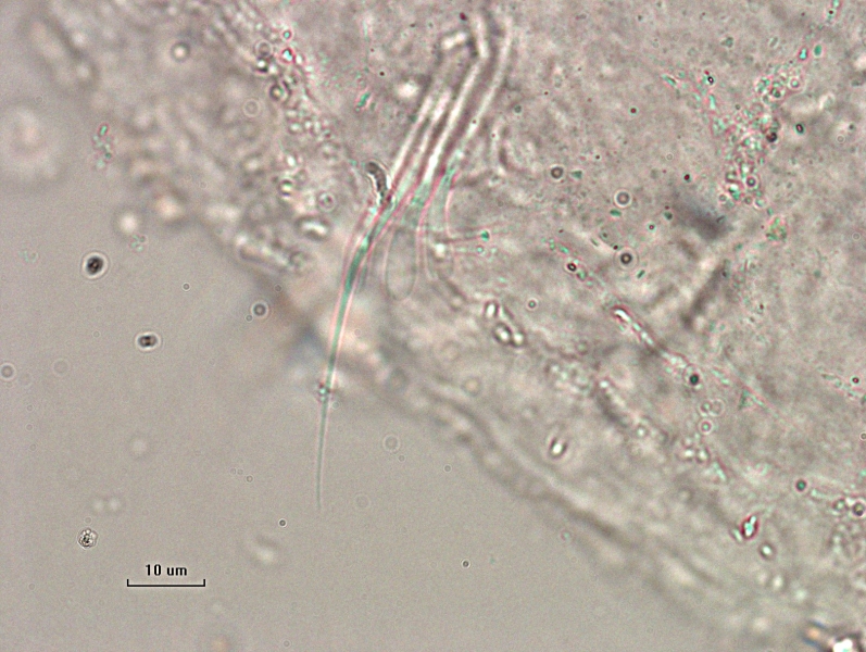 photomicrograph of part of a freshwater oligochaete worm showing a bundle of chaetae with a couple hairs and spoon-shaped chaetae that are slightly hard to distinguish, an arrow pointing to the chaetae