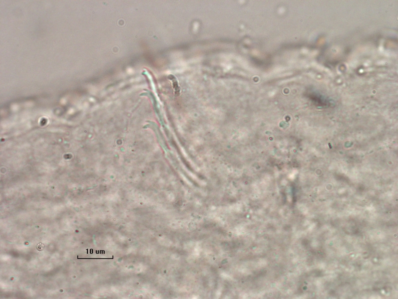 photomicrograph of part of a freshwater oligochaete worm showing a bundle of chaetae  with the upper tooth much shorter and thinner than the lower tooth