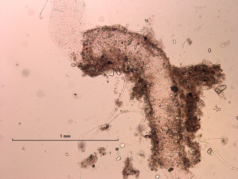 photomicrograph of part of a freshwater oligochaete worm showing the body covered in a sediment tube and foreign material