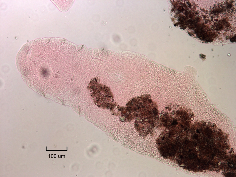 photomicrograph of a mature freshwater oligochaete worm with a thickened clitellum, a pene, and some penial chaetae
