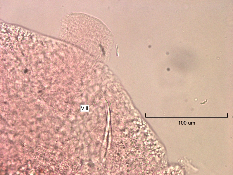 photomicrograph of part of a mature freshwater oligochaete worm with a thickened clitellum, a true pene without a cuticle, and some penial chaetae that are spear shaped labeled VIII
