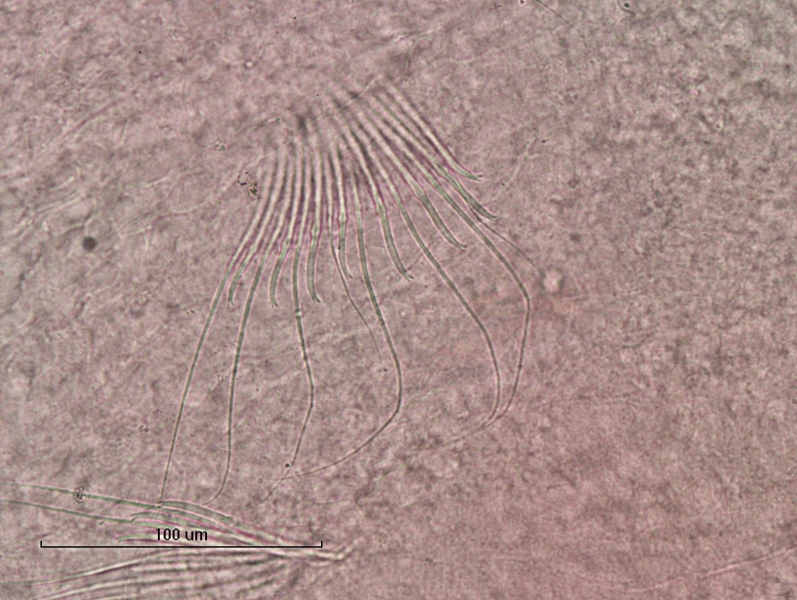 photomicrograph of part of a freshwater oligochaete worm showing a bundle of 8 chaetae and 8 hairs. The bifid chaetae have the upper tooth shorter and thinner than the lower tooth
