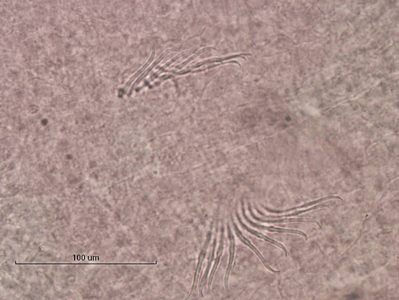 photomicrograph of part of a freshwater oligochaete worm showing two bundles of 8-10 bifid chaetae with the upper tooth shorter and thinner than the lower tooth