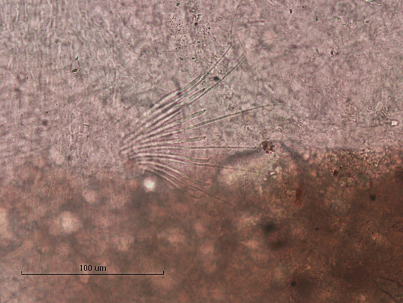 photomicrograph of part of a freshwater oligochaete worm showing a bundle of 7 chaetae and 6 hairs. Some of the chaetae are shown from the front and you cannot see that they are bifid. Instead, they look slightly wider than expected with a dot at the top where bifid teeth are slightly visible.