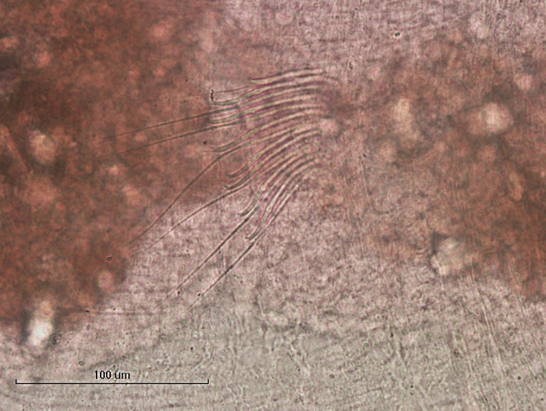 photomicrograph of part of a freshwater oligochaete worm showing a bundle of 8 chaetae and 7 hairs. The bifid chaetae have the upper tooth shorter and thinner than the lower tooth. All of the chaetae are facing the side so you can see the bifid teeth.