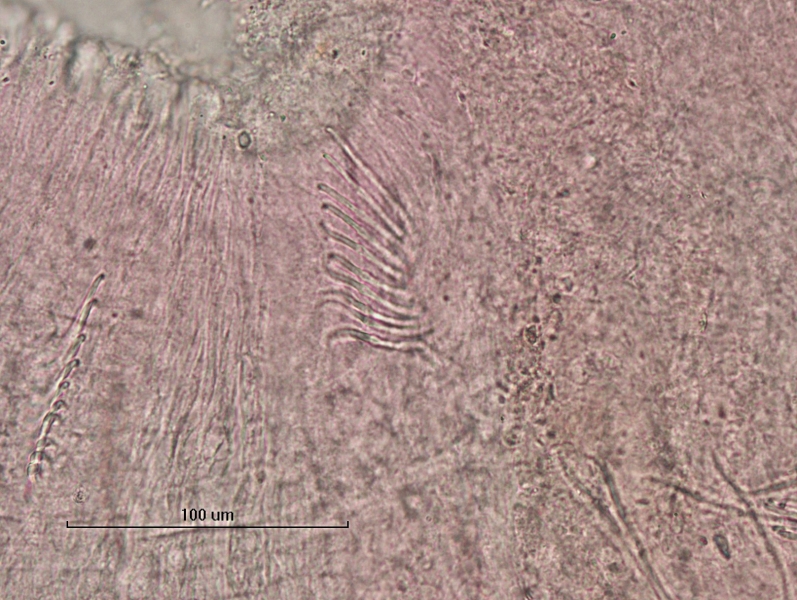photomicrograph of part of a freshwater oligochaete worm showing a bundle of 11 chaetae. Some of the chaetae are shown from the front and you cannot see that they are bifid. Instead, they look slightly wider than expected with a dot at the top where bifid teeth are slightly visible.