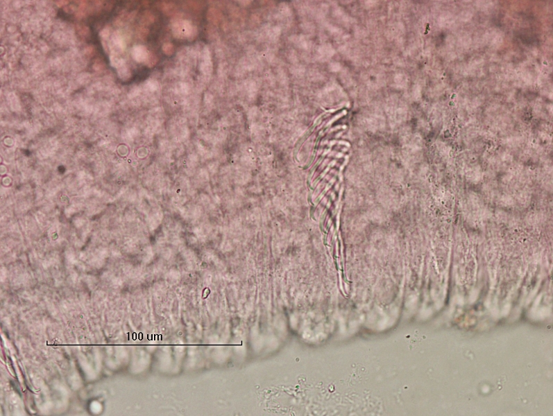 photomicrograph of part of a freshwater oligochaete worm showing a bundle of 11 bifid chaetae with the upper tooth shorter and thinner than the lower tooth