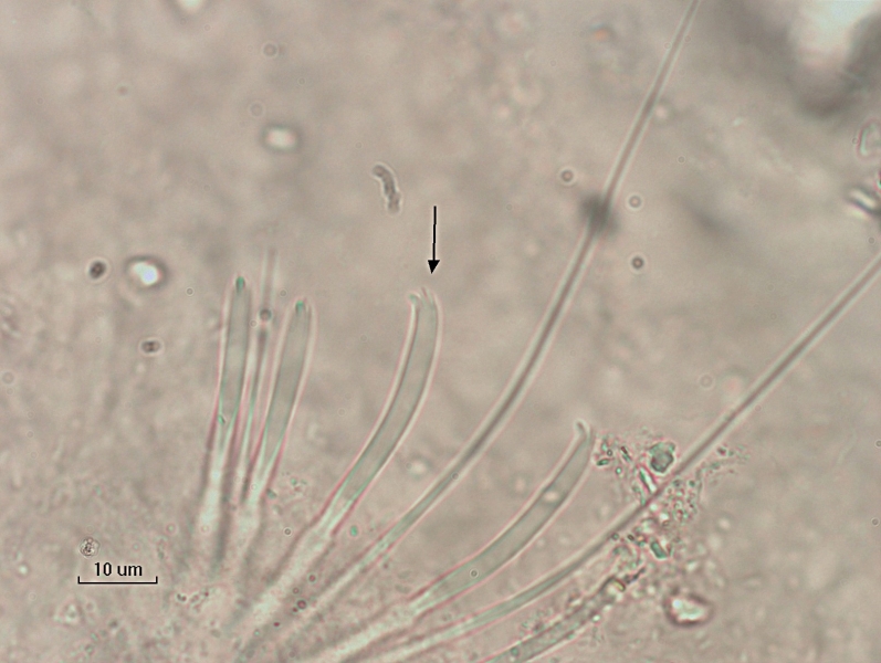 photomicrograph of part of a freshwater oligochaete worm showing a bundle of 5 chaetae and 3 hairs very zoomed in. An arrow is pointing to one of the chaetae which has a short lower tooth and several short, very thin upper teeth.