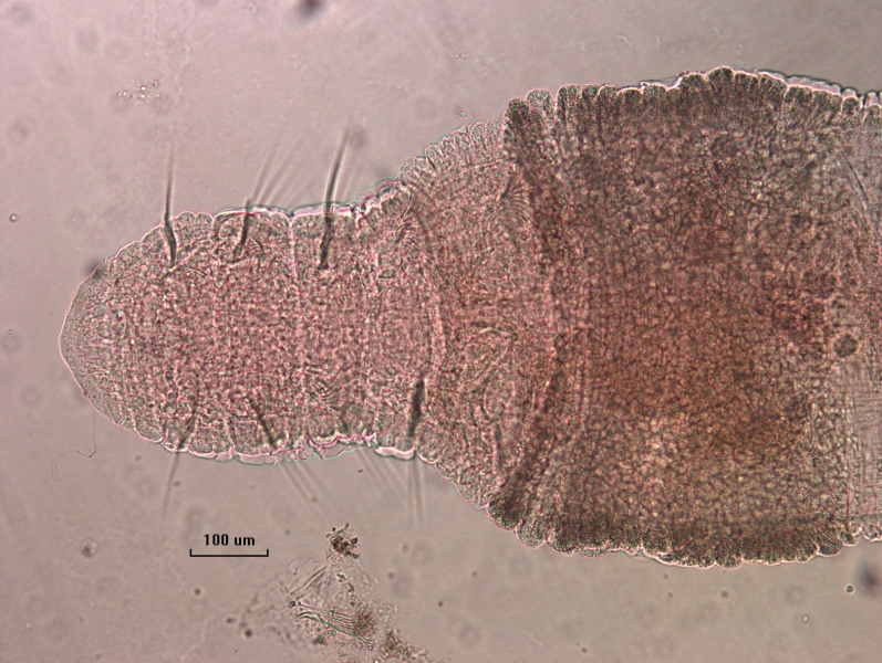photomicrograph of the front half of a freshwater oligochaete worm with a thickened clitellum starting in V and dorsal hairs.