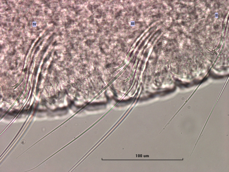 photomicrograph of part of a freshwater oligochaete worm showing the bundles in segments II, III, and IV, which include several hairs and slightly curved bifid chaetae. Some of them look like they might have a faint replicated tooth attached to the lower bifid tooth.