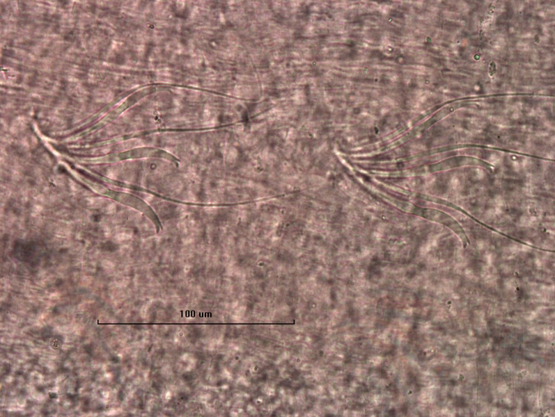photomicrograph of part of a freshwater oligochaete worm showing two bundles with three hairs and three slightly curved bifid chaetae. Some of them look like they might have a faint replicated tooth attached to the lower bifid tooth.