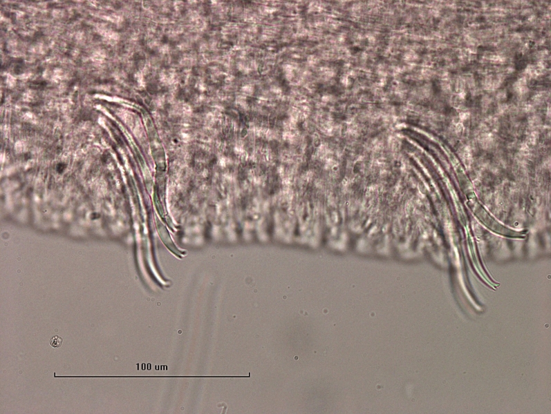 photomicrograph of part of a freshwater oligochaete worm showing two bundles that have about 4 slightly curved bifid chaetae with short upper teeth. There may be some replicated teeth on one chaeta. Scale 100 um.