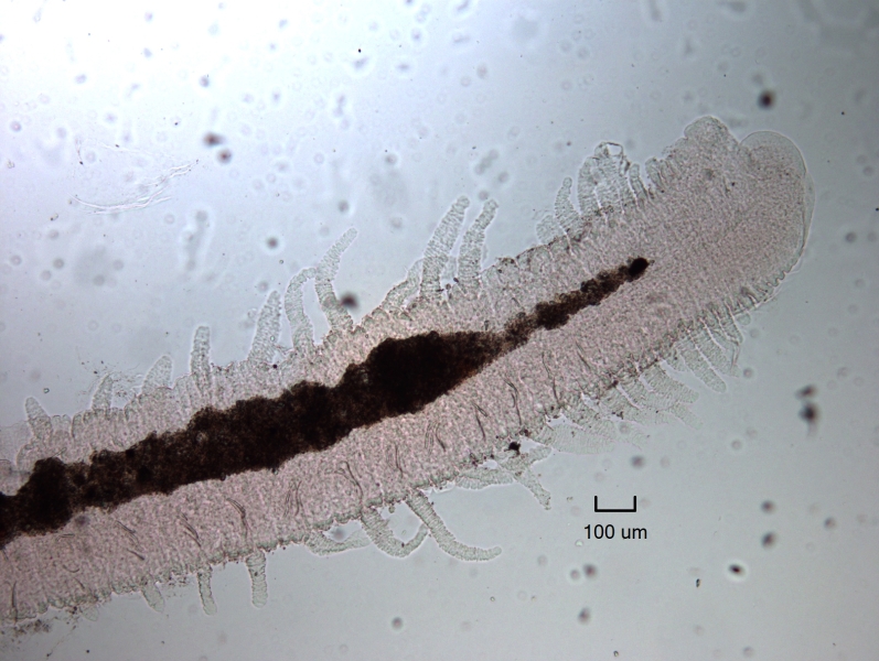 photomicrograph of the tail of a freshwater oligochaete worm with a fringe of fingerlike gills coming from either side of each segment. Scale 100 um.