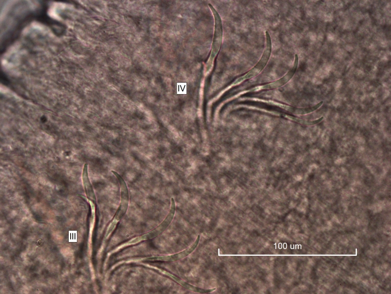 photomicrograph of part of a freshwater oligochaete worm showing bundles in segments III and IV that have about 5 slightly curved simple-pointed chaetae. Scale 100 um.