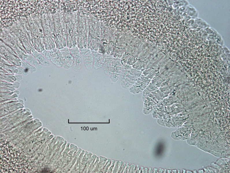 photomicrograph of the tail of an embryonic freshwater oligochaete worm with some fingerlike gills coming the side of the posterior end. Scale 100 um.
