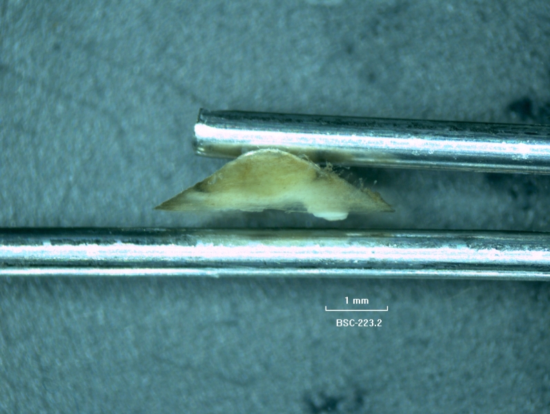 photomicrograph of a limpet snail held between two forceps, a translucent domed shell with no whorls. The apex is mostly centered.