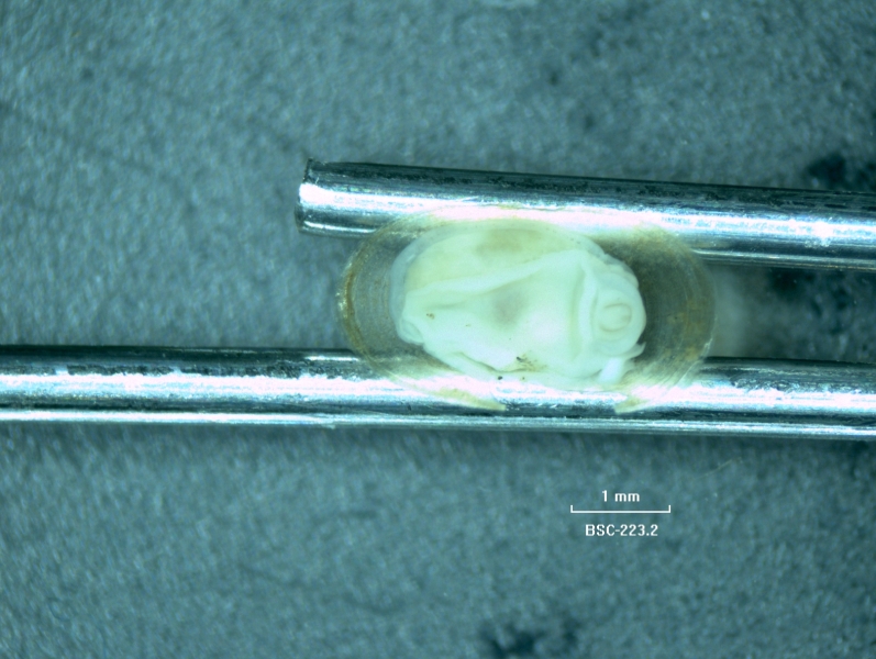 Photomicrograph of the bottom of a limpet snail showing the body, mouth, and foot, under an oval-shaped shell.