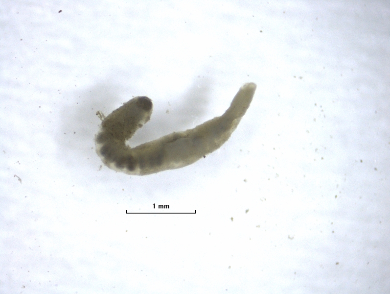 Photomicrograph of a worm with a thickened clitellum. A scale bar shows 1 mm.