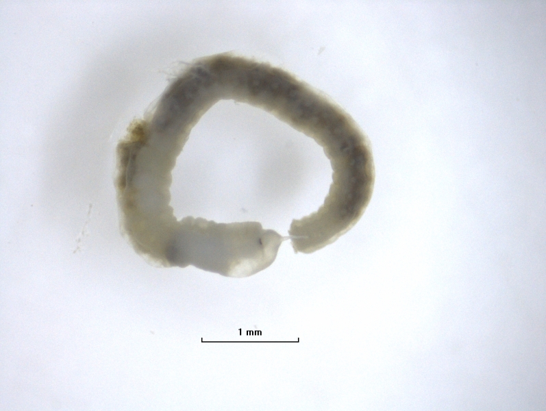 Photomicrograph of a whole worm with a bulbous head, eyespots, and a proboscis