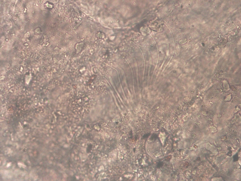 photomicrograph of part of a freshwater oligochaete worm showing a bundle of 6 chaetae and 6 hairs partially visible through a coating of foreign matter
