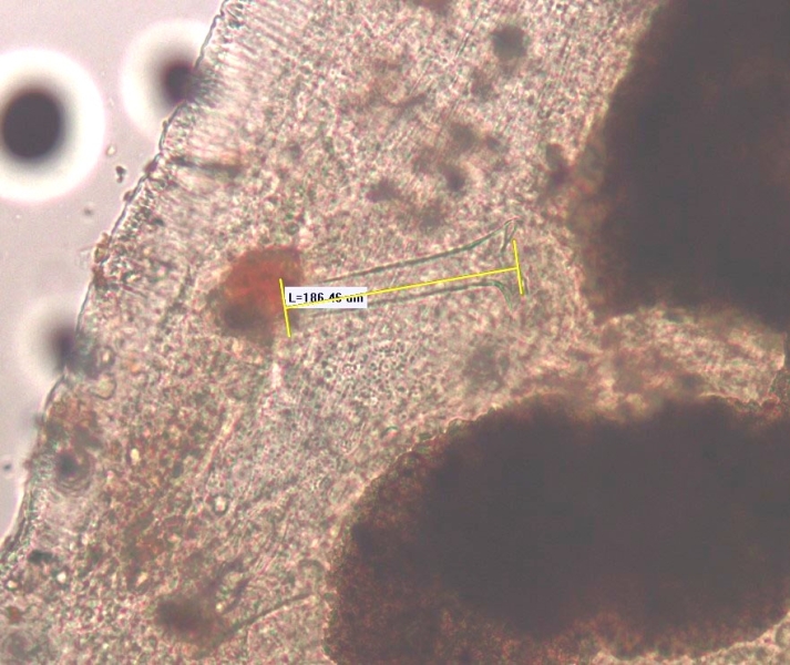 Photomicrograph of the reproductive part of a worm. There is a penis sheath that is longer than it is wide with a flared end. There is a measurement bar that is labelled "L=186.46 µm."