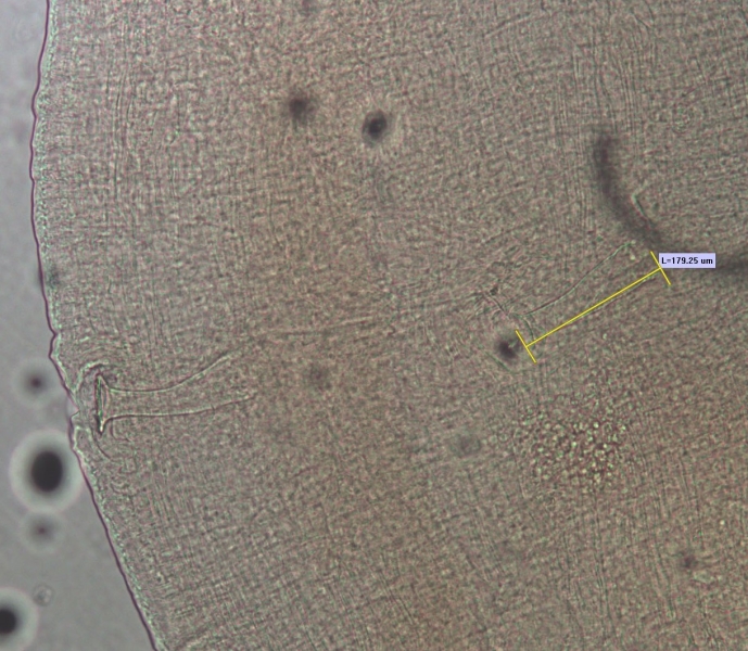 A microscope photo of the reproductive parts of a worm. There are two penis sheaths that are about four times as long as they are wide. One is measured by a bar labelled "L=179.25 µm."