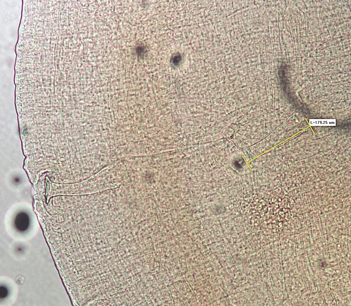 Photomicrograph of the reproductive parts of a worm. There are two penis sheaths that are about four times as long as they are wide. One is measured by a bar labelled "L=179.25 µm."